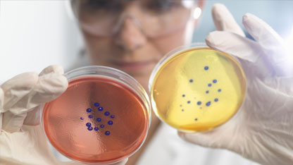 woman comparing two petri dishes